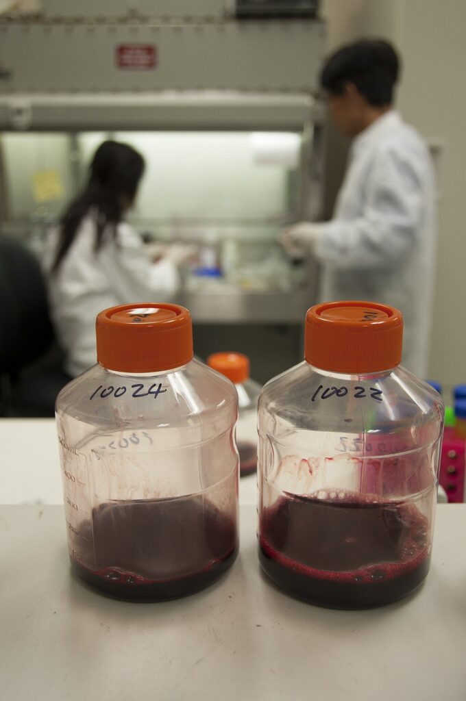 Hem z hemoglobiny może hamować rozpuszczanie skrzepów krwi Hem z hemoglobiny może hamować rozpuszczanie skrzepów krwi